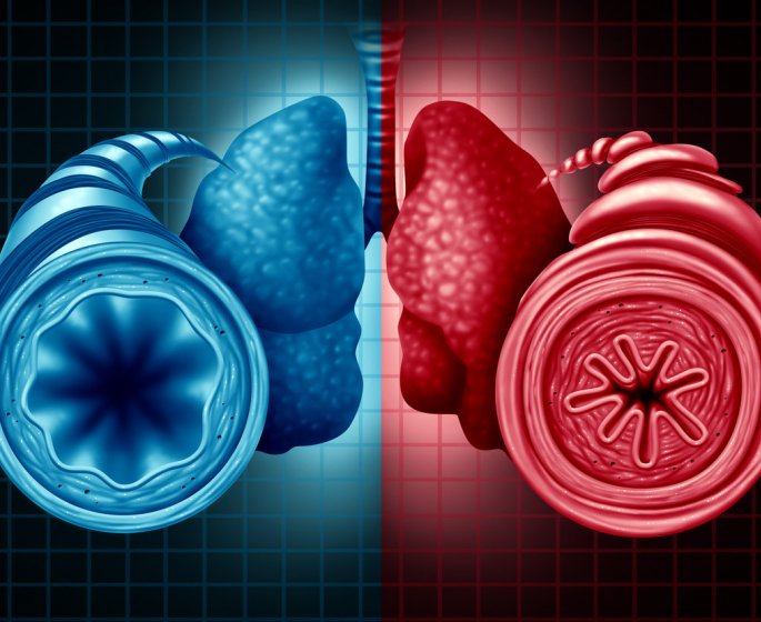 Asthme Allergique : symptomes, traitements, causes