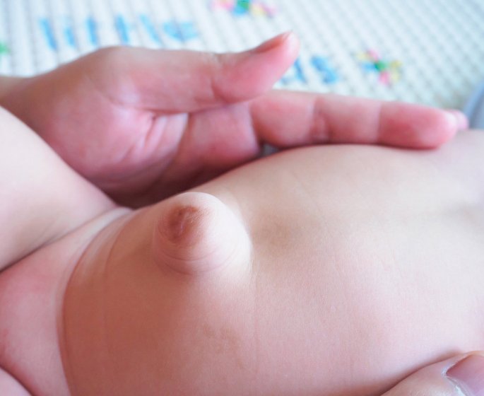 Hernie de la paroi abdominale (ou incisionnelle) : symptomes et traitements