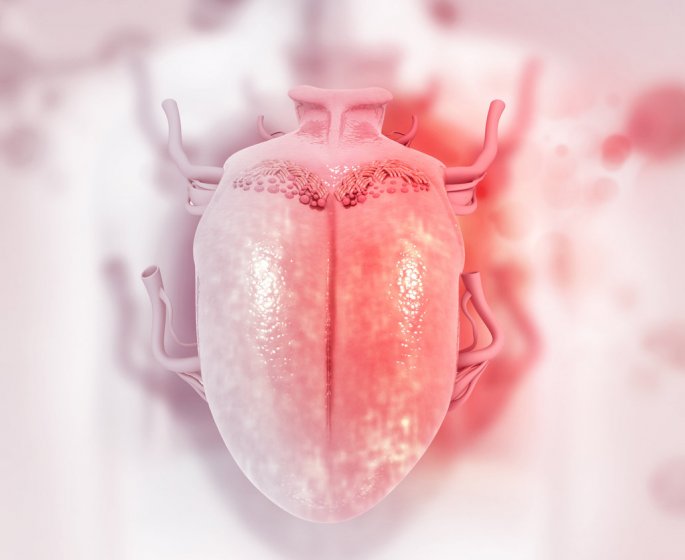 Glossite (inflammation de la langue) : causes, traitements pour la soigner