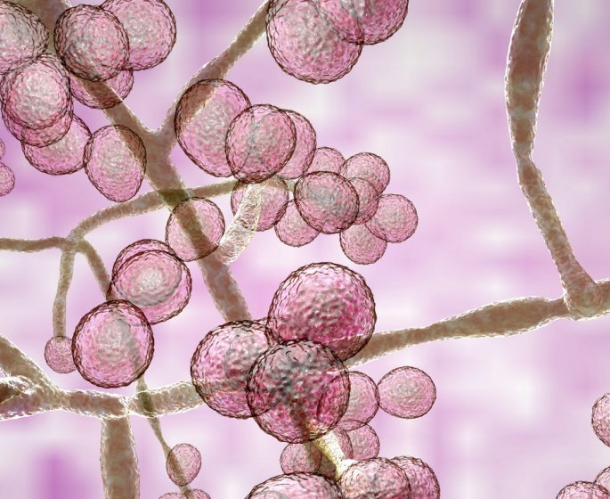 Candidose (candida) : symptomes, traitements pour la soigner, causes