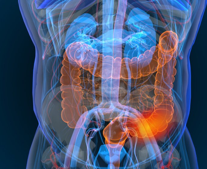 Symptomes esperance de vie causes et traitements du cancer colorectal