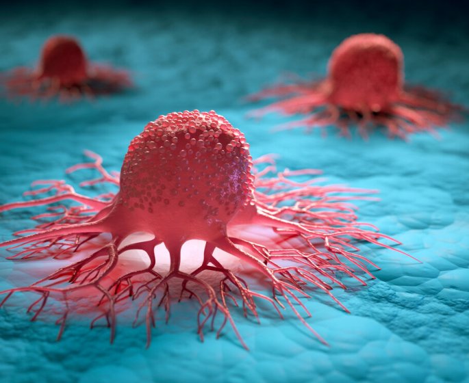 Cancer : reduire de 10 % les aliments ultra-transformes diminue les risques