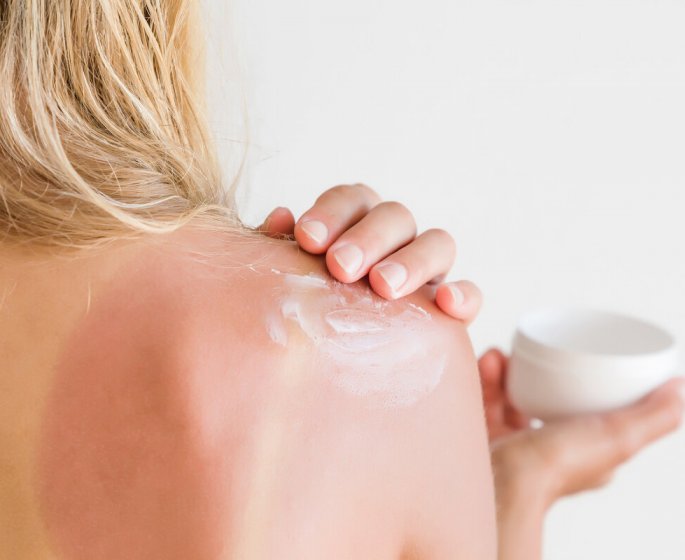 Les 7 meilleurs aliments pour eviter les coups de soleil