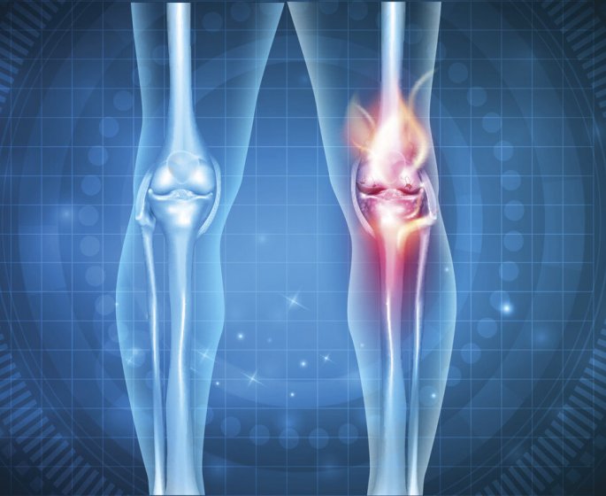 Comment mieux prendre en charge les douleurs post-operatoires ? 