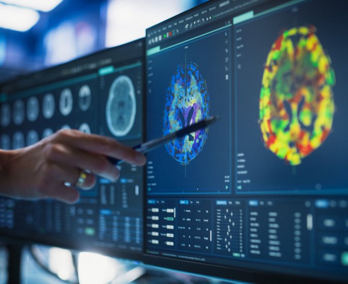 Le Covid-19 a fait vieillir notre cerveau… meme sans attraper le virus