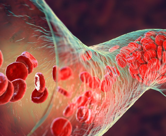 Des nuits plus courtes favorisent les maladies arterielles peripheriques