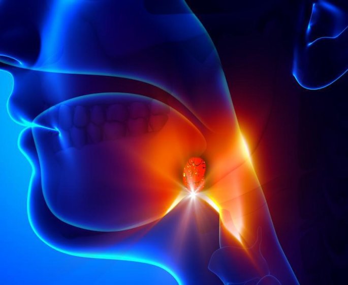 Phlegmon amygdalien (ou de l-amygdale) : symptomes, causes, traitements