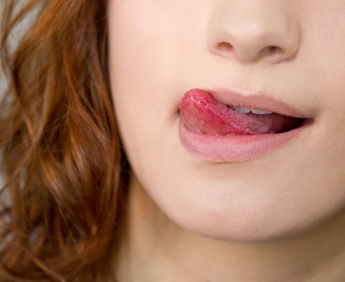 Infection au coin des levres : qu-est-ce que la perleche ?