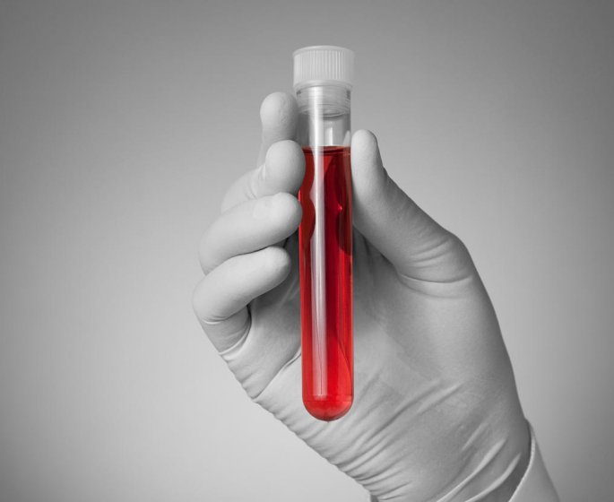 Trop de ferritine dans le sang : est-ce dangereux ?