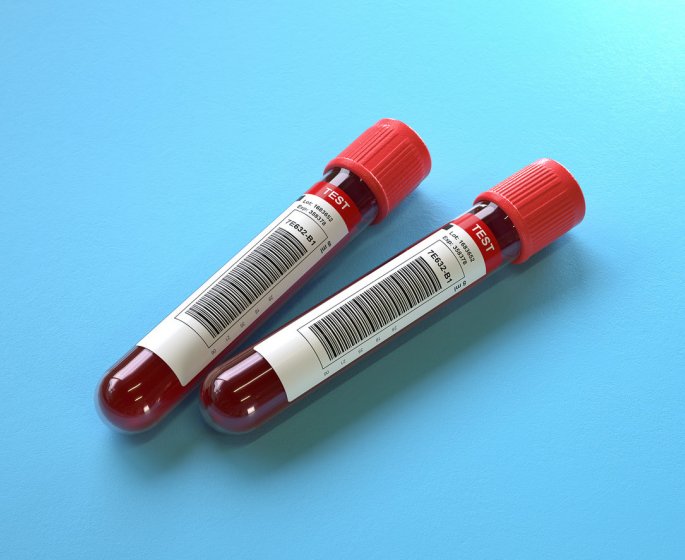 Alat eleve mais asat normal : notre guide pour comprendre le fonctionnement des maladies du foie 