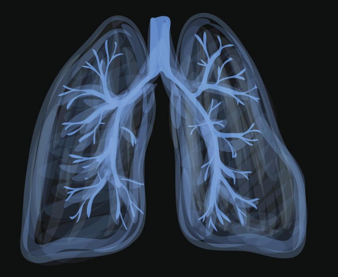 Pneumothorax spontane : la definition
