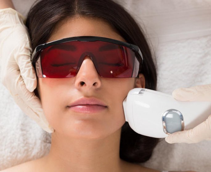 Epilation a la lumiere pulsee : brulures, douleurs... L-alerte de l-Anses