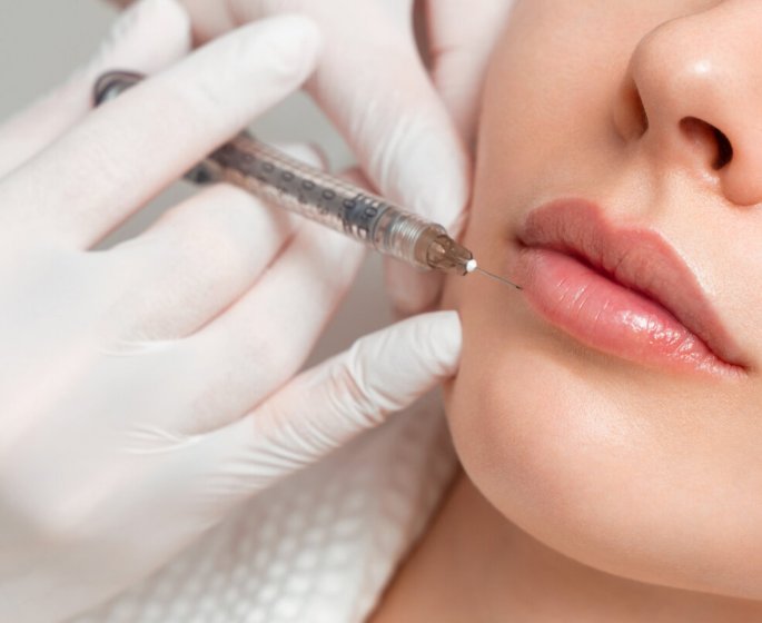 Qu’est-ce que le Russian Lips, cette technique pour des levres pulpeuses ?