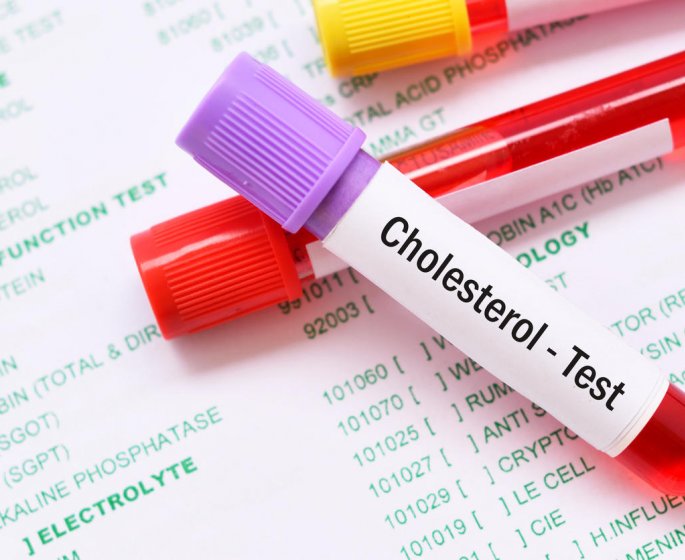Cholesterol HDL bas : quels sont les risques ?