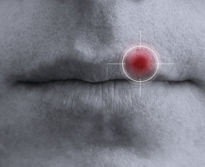 Herpes : peut-on en mourir ? 