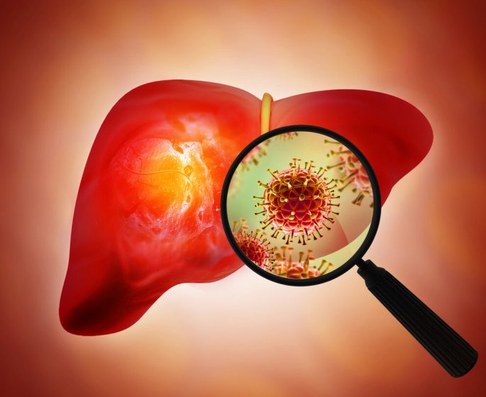 Recrudescence des cas d’hepatites en Europe depuis le debut de l’ete : des milliers de Francais contamines sans le savoir