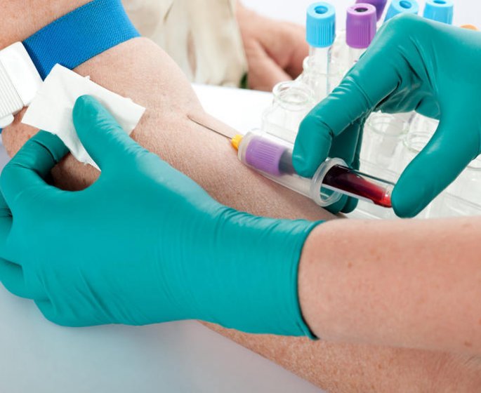  Alzheimer : la maladie bientot diagnostiquee grace a une prise de sang ?