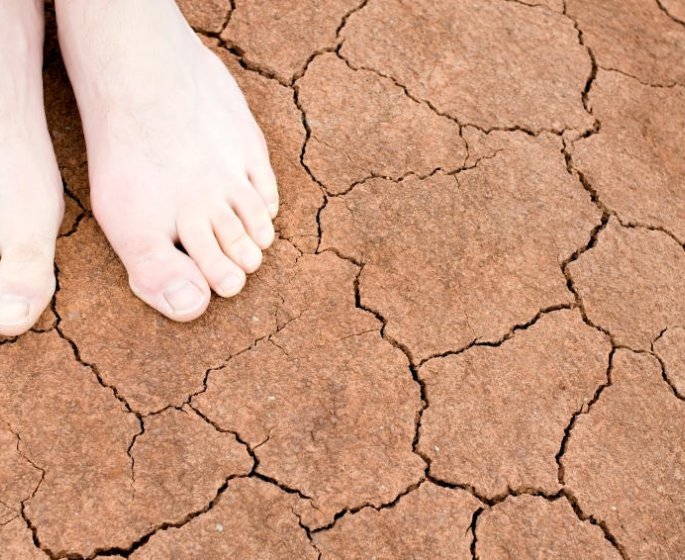 3 astuces anti pieds secs