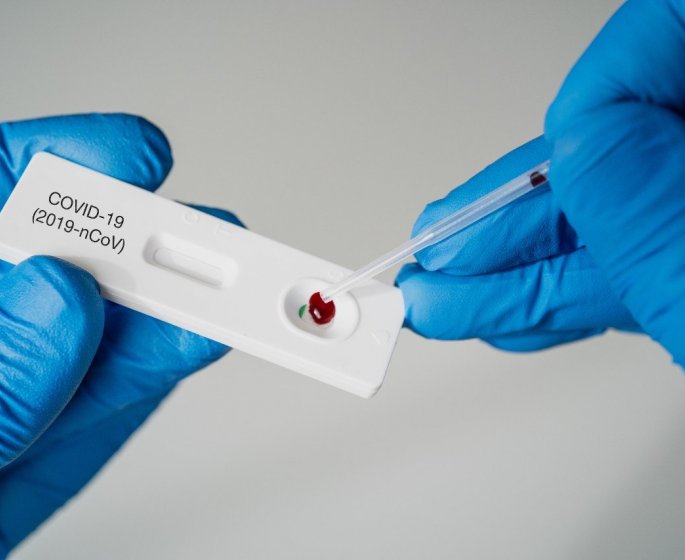  Tests antigeniques : cette marque retiree du marche a cause de &quot;faux positifs&quot;