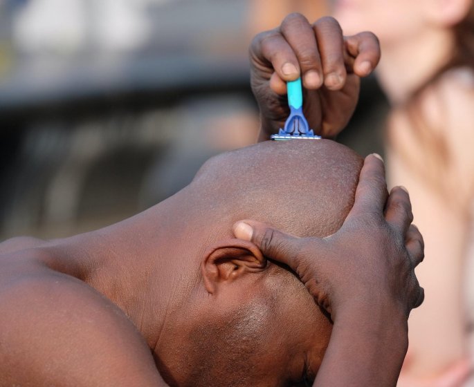 Calvitie : l’adopter ou la dompter ?