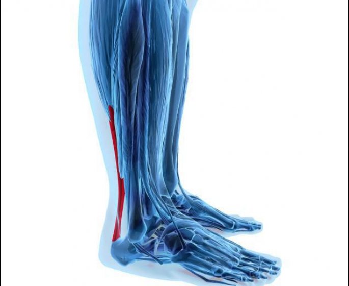 Rupture du tendon d-Achille : l-operation obligatoire ?