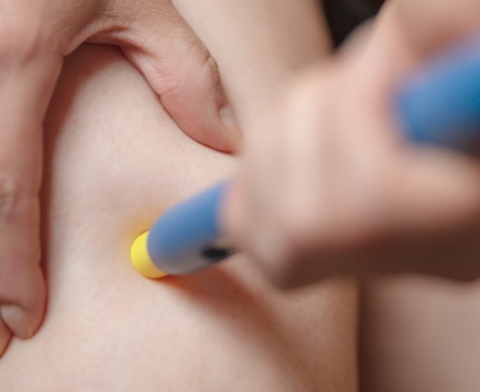 AVF : les conseils d’une patiente pour se faire les piqures 
