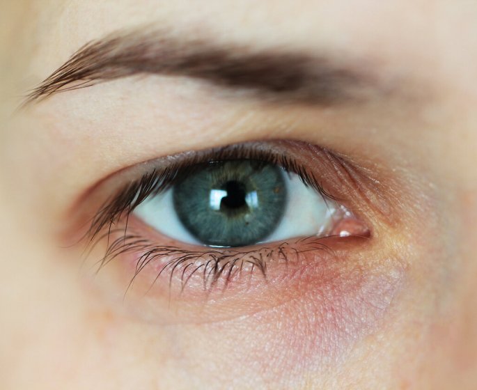 Melanome uveal : un cancer oculaire rare a detecter tot