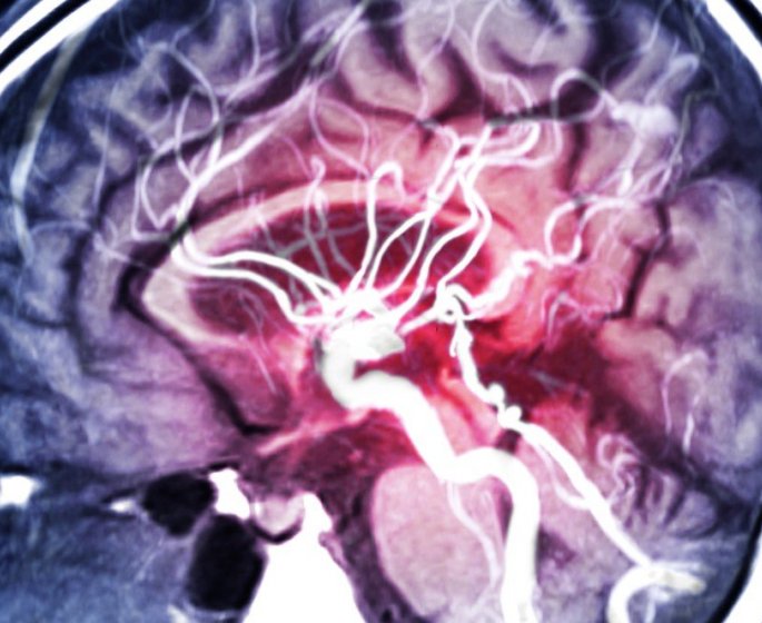 Son AVC a 33 ans lui a "fait perdre des millions de neurones"