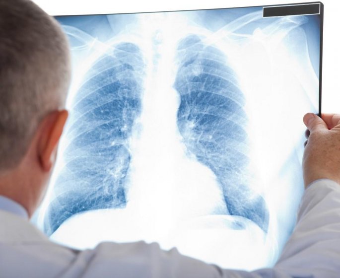 Tuberculose : un autre cas detecte dans le Loire-Atlantique