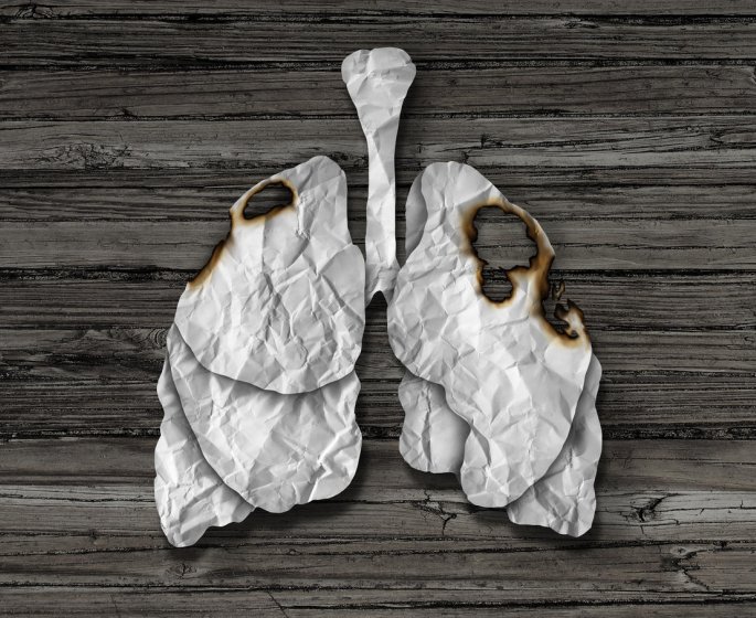 Cancer du poumon : 5 mythes sur la maladie a ne plus croire