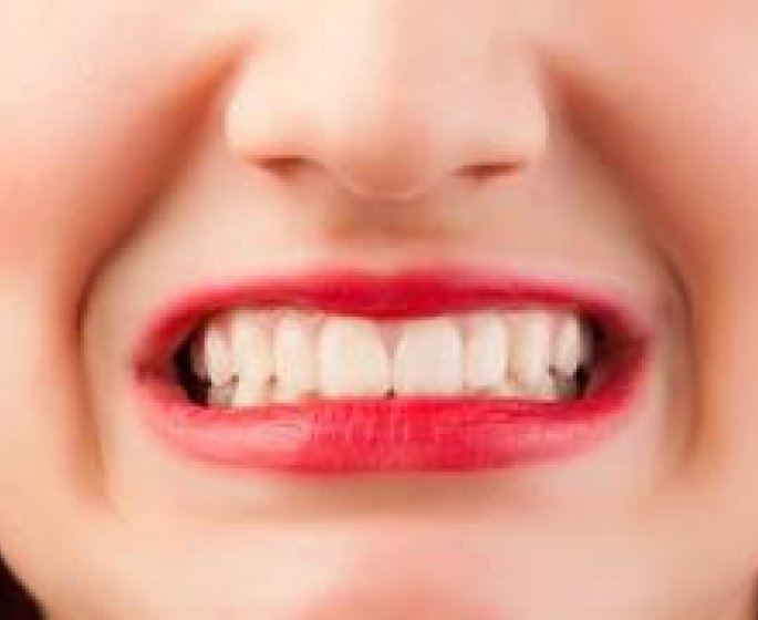 10 mauvaises habitudes qui abiment vos dents