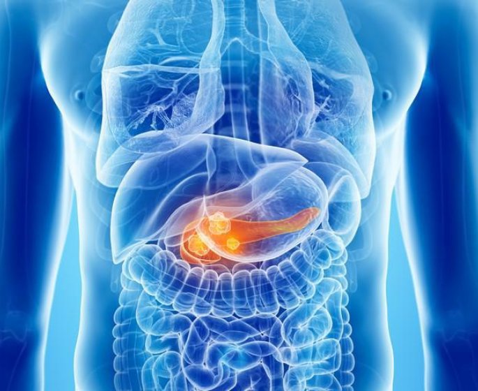 Cancer agressif : les 4 choses que vous ne savez pas