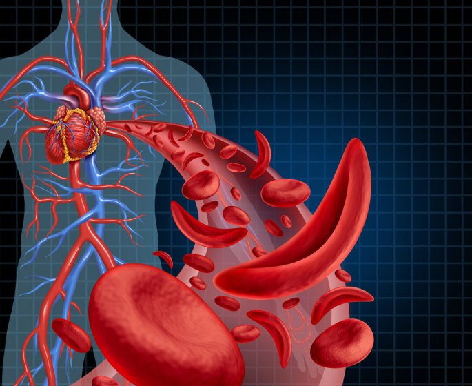 Drepanocytose : quelle est cette maladie genetique tres repandue ?
