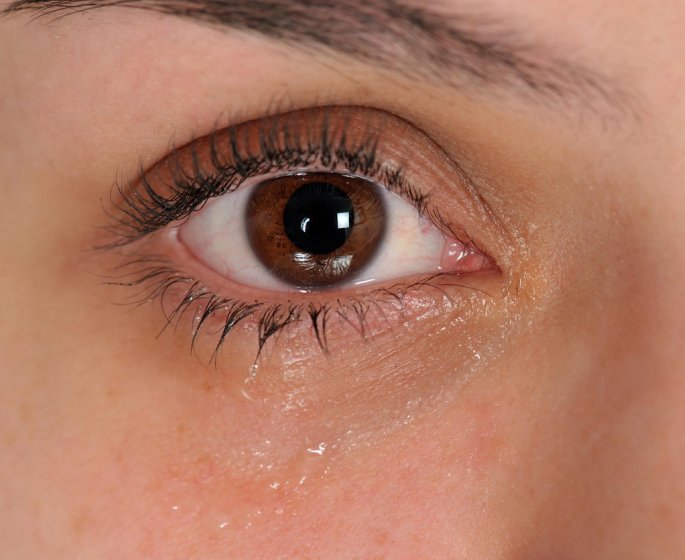 Yeux gonfles qui pleurent : blepharite ou conjonctivite ?