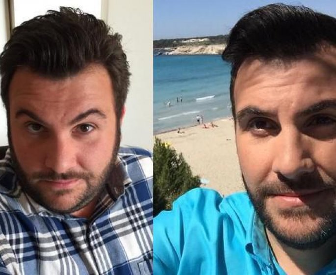 Laurent Ournac : il a pese jusqu-a 142 kilos