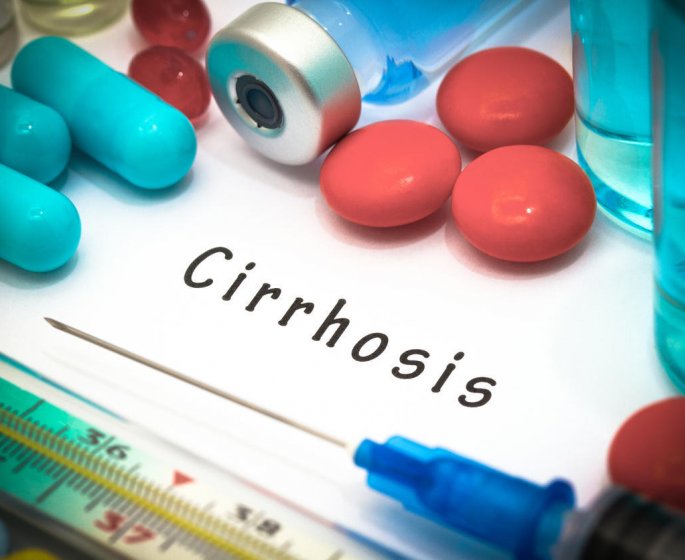 Cirrhose biliaire primitive : le diagnostic par biopsie