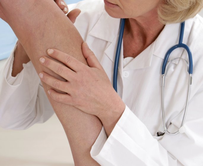 La chirurgie des varices