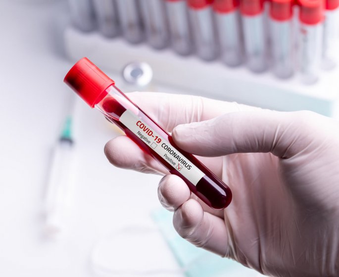 Test serologique : les conditions pour se faire rembourser