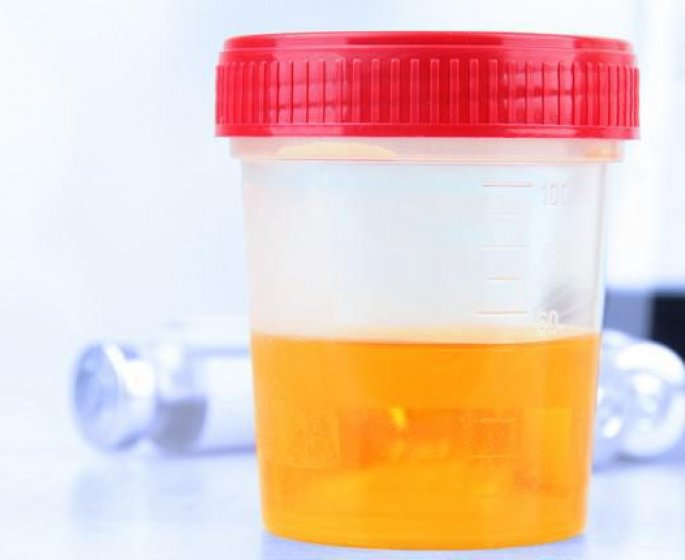 La luminosite de votre urine pourrait aider a deceler un cancer du foie