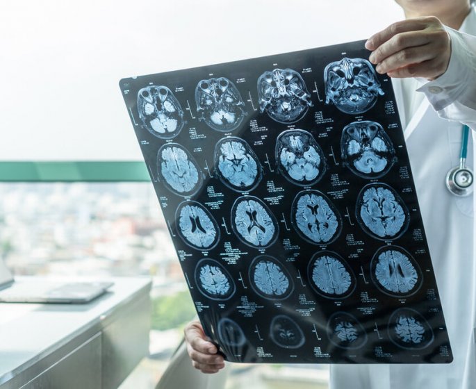 La maladie d’Alzheimer pourrait etre transmissible d’apres une etude