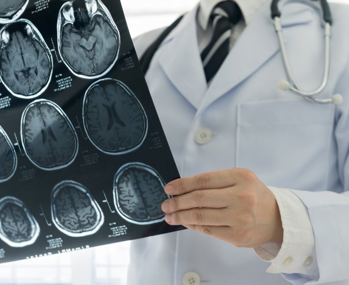 La sotagliflozine contre le diabete est efficace contre les accidents vasculaires