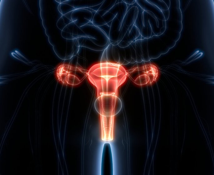 Quelle est la difference entre l’endometriose et le cancer de l’endometre ?