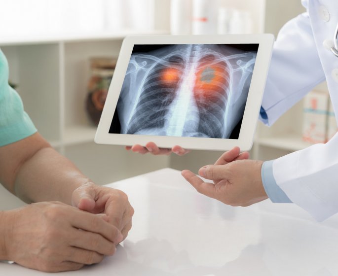 Covid-19 : les cancers les plus dangereux en cas d-infection