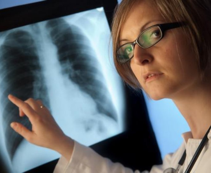 Cancer : les metastases pulmonaires