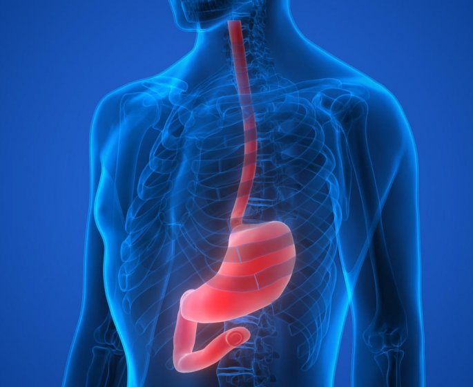 Reflux gastrique : l-alginate de sodium comme traitement