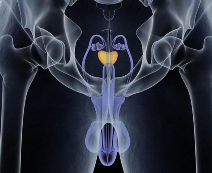 Prostate : la caracteristique qui peut renseigner sur le risque de cancer