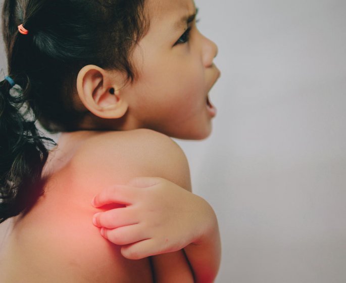 Zona : les symptomes chez l-enfant