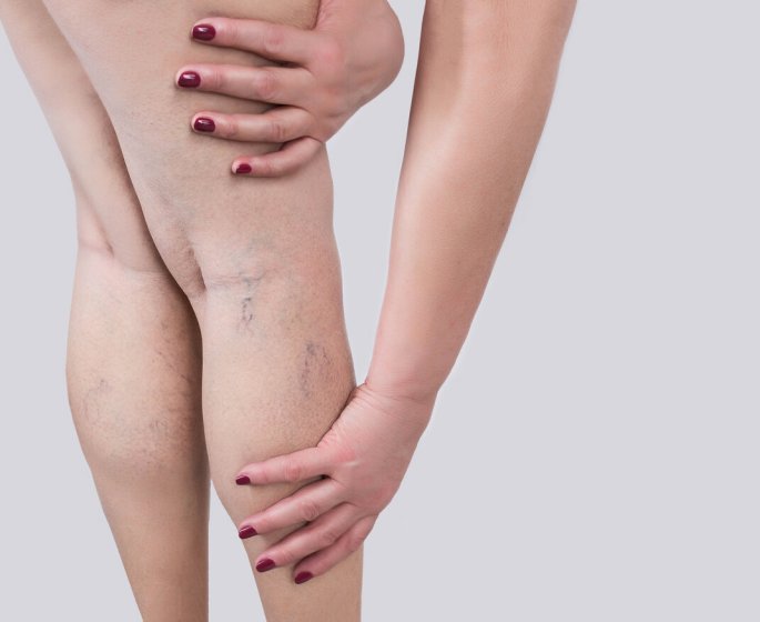 Syndrome des jambes sans repos : ce medicament n-est pas recommande selon ce medecin