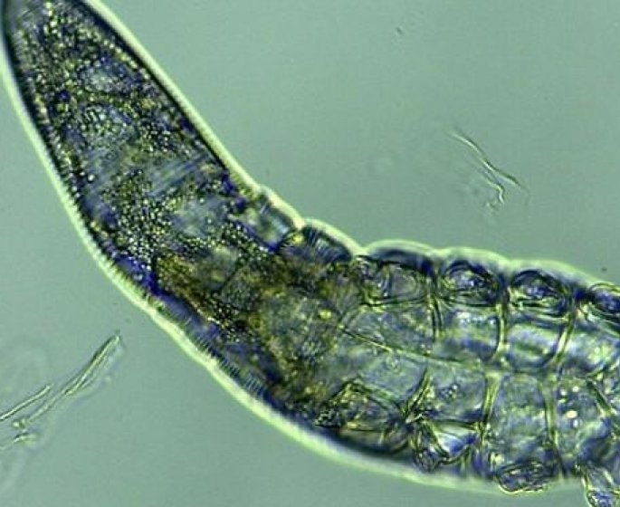 Cet insecte se cache dans vos cils et vos sourcils