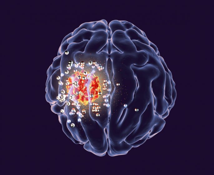 Les crises de rires de leur enfant etaient causees par une tumeur au cerveau